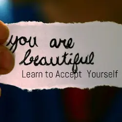 You are beautiful. Learn to accept yourself.