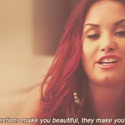 Your imperfections make you beautiful, they make you who you are.
