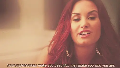 Your imperfections make you beautiful, they make you who you are.